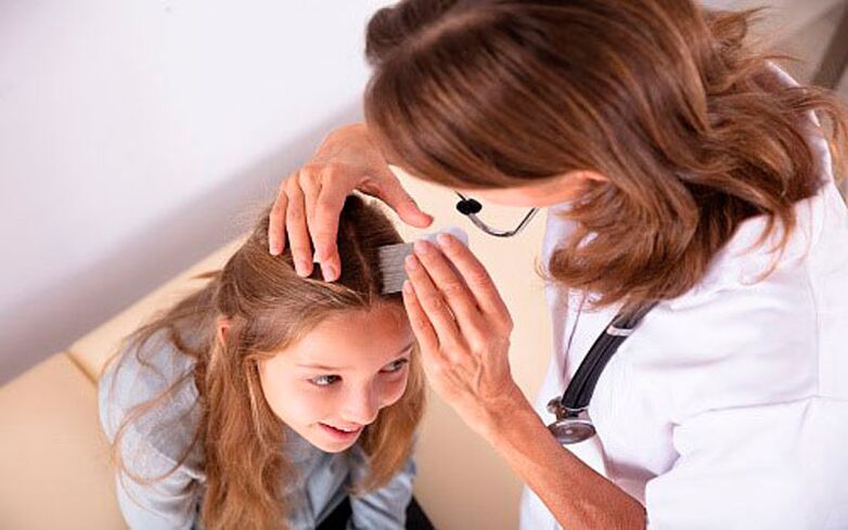 leczenie łuszczycy głowy u dzieci