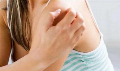 dziewczyna drapie się po ramieniu